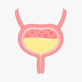 Doenças inflamatórias ou infecciosas